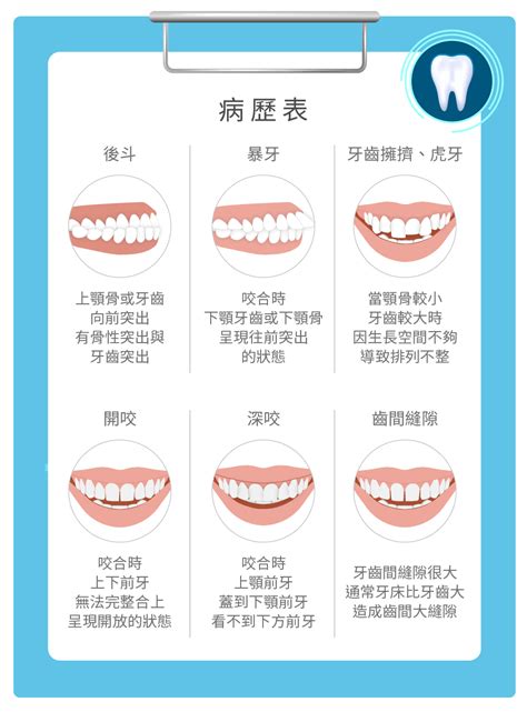 嘴巴閉起來牙齒|咬合不正怎麼辦？3分鐘認識咬合類型、症狀與矯正方。